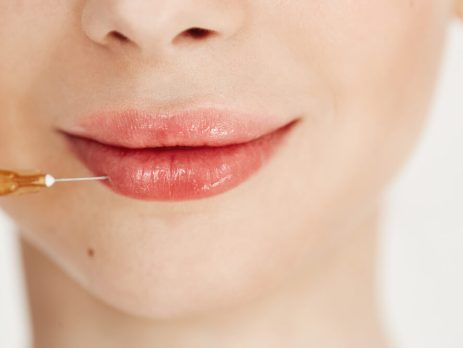 How-Does Botox Lip Flip Work?