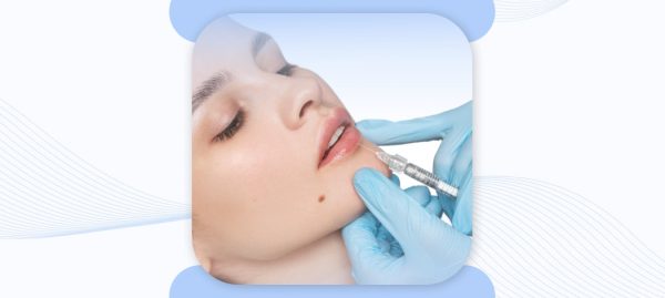 Best filler for lips