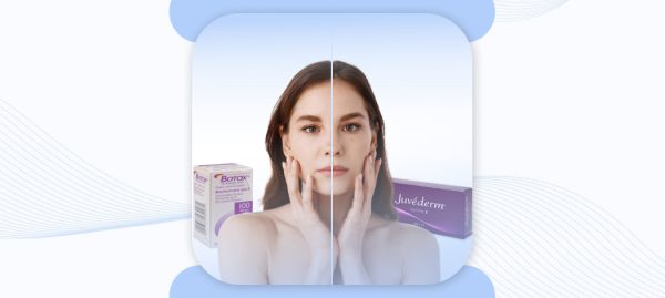 Juvederm vs botox Which is better