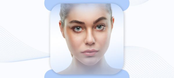 belotero under eyes
